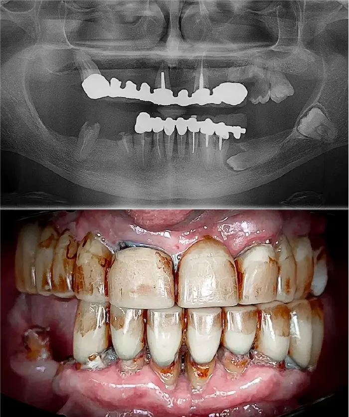 Zygoma quad prima - Dental Center